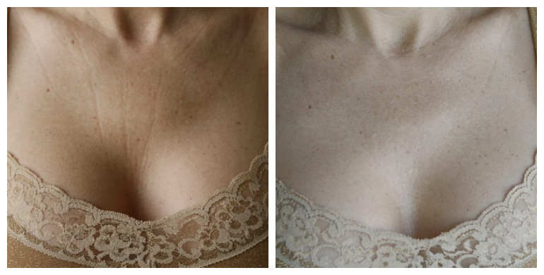 Resultado de antes y después de Maria